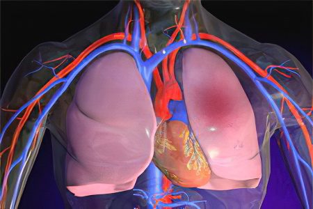 Symptoms, causes and treatment of pulmonary edema