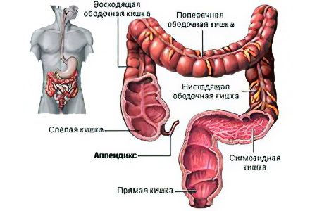 Symptoms of appendicitis