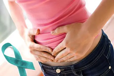 Symptoms, stages and treatment of ovarian cancer in women