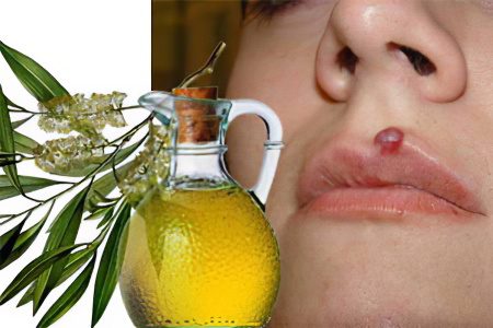 Tea tree oil