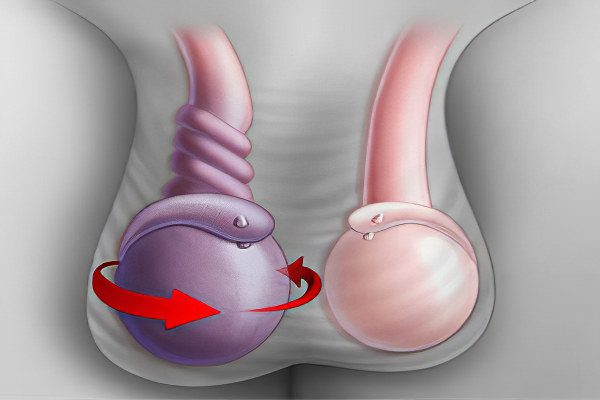 Testicular pain in men: causes and treatment