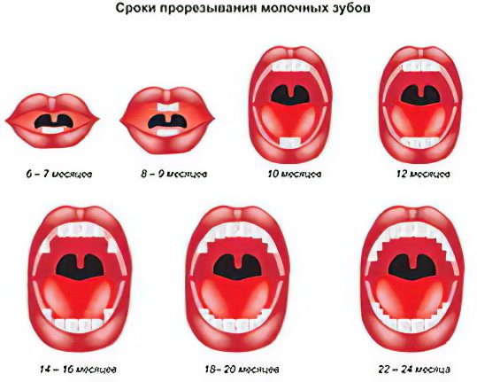 The order (scheme) of eruption of milk teeth in children