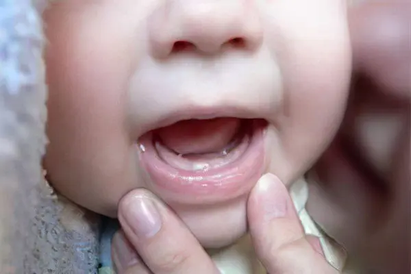 The order (scheme) of eruption of milk teeth in children