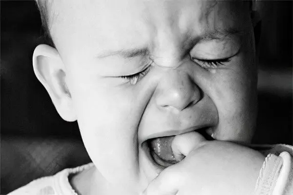 The order (scheme) of eruption of milk teeth in children