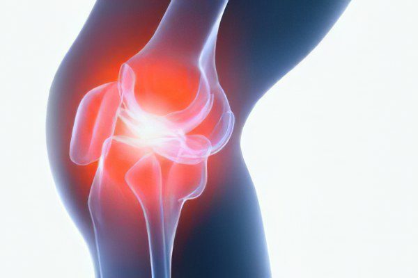 Treatment and operation of a Bakers cyst of the knee joint