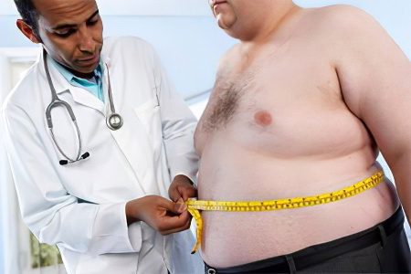 Treatment of obesity in men