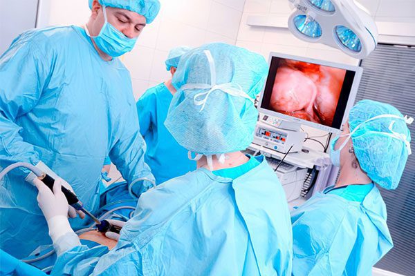 Treatment of uterine fibroids in Israel