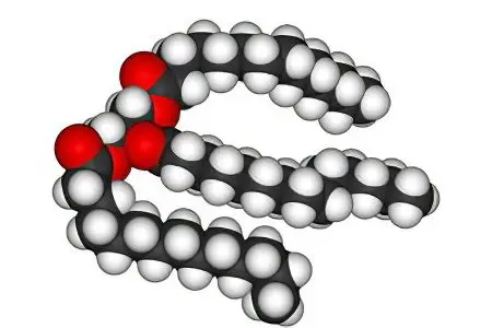 Triglycerides: high, low, normal