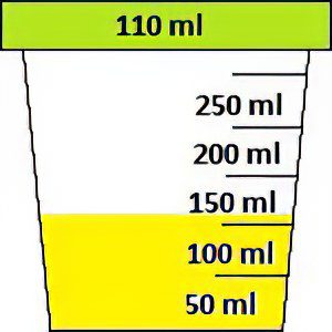 Urinalysis according to Zimnitsky: what does it show?