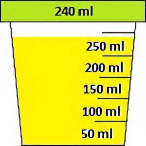 Urinalysis according to Zimnitsky: what does it show?