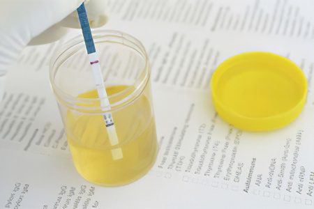 Urinalysis according to Zimnitsky: what does it show?