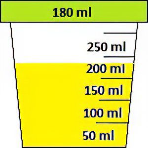 Urinalysis according to Zimnitsky: what does it show?