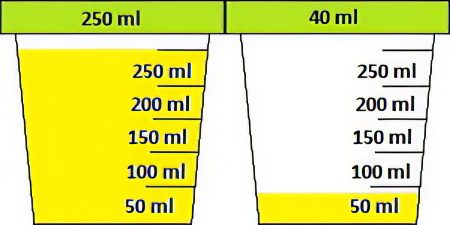 Urinalysis according to Zimnitsky: what does it show?