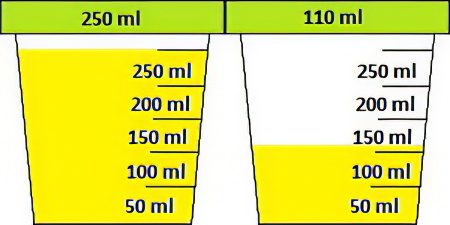 Urinalysis according to Zimnitsky: what does it show?