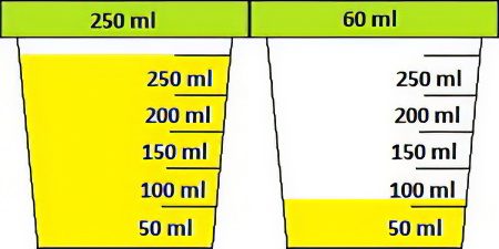 Urinalysis according to Zimnitsky: what does it show?