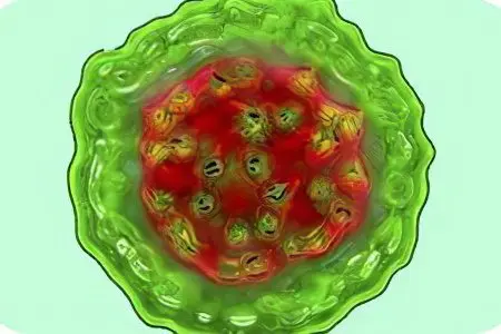 Viral hepatitis D