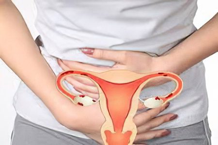 Visanne for endometriosis