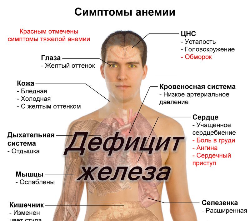 What are the types of anemia and how do they differ?