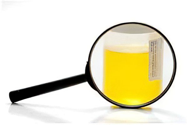 What is a urine test according to Nechiporenko?