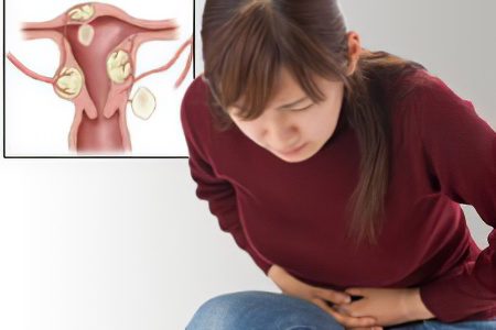 What is dangerous and how to treat uterine fibroids? Causes and symptoms