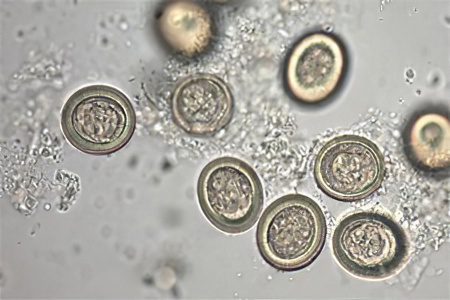 What is the route of transmission of roundworm eggs to humans?