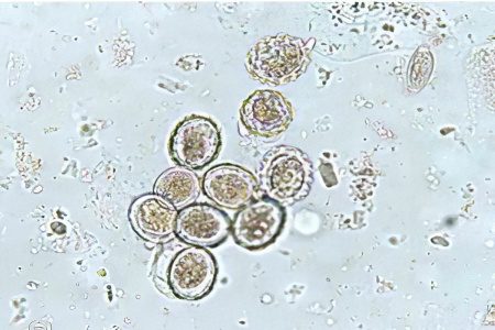 What is the route of transmission of roundworm eggs to humans?