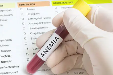 What tests should be done for anemia?