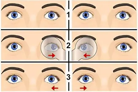 What to do if you suspect strabismus?