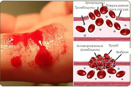 Willebrand disease: how to treat?