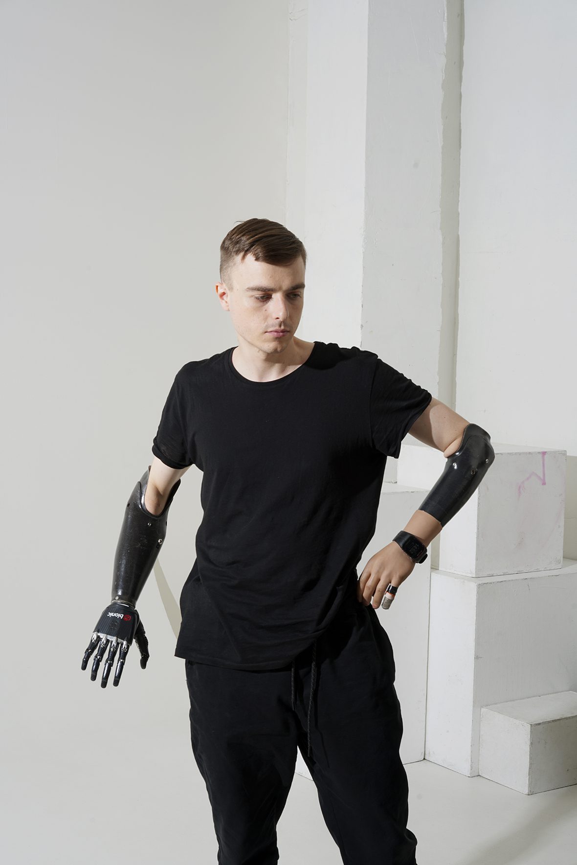 With an iron character: how people with bioprostheses live. Photo gallery