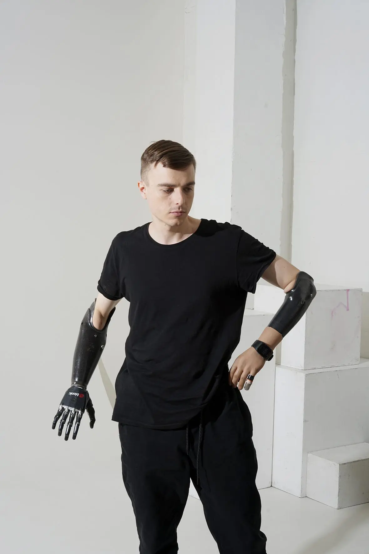 With an iron character: how people with bioprostheses live. Photo gallery