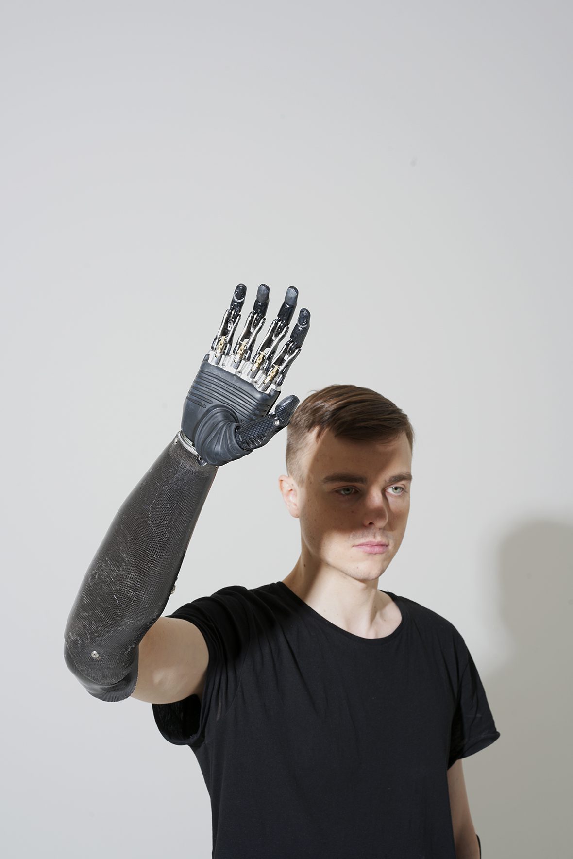 With an iron character: how people with bioprostheses live. Photo gallery