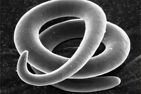 Worms: the first signs and symptoms