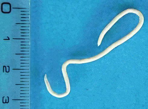 Worms: the first signs and symptoms