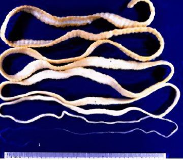 Worms: the first signs and symptoms