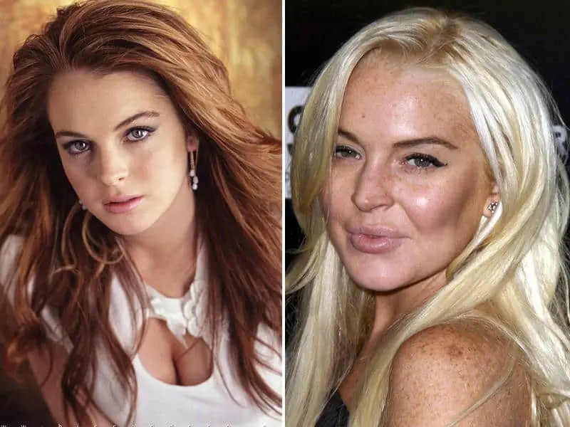 10 actresses whose career ended due to the fault of plastic surgeons