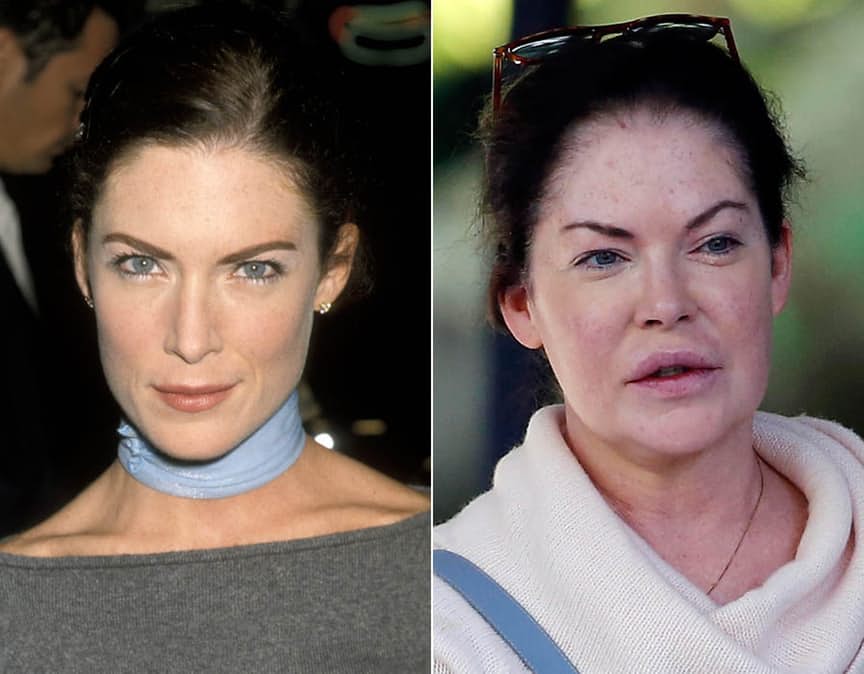 10 actresses whose career ended due to the fault of plastic surgeons