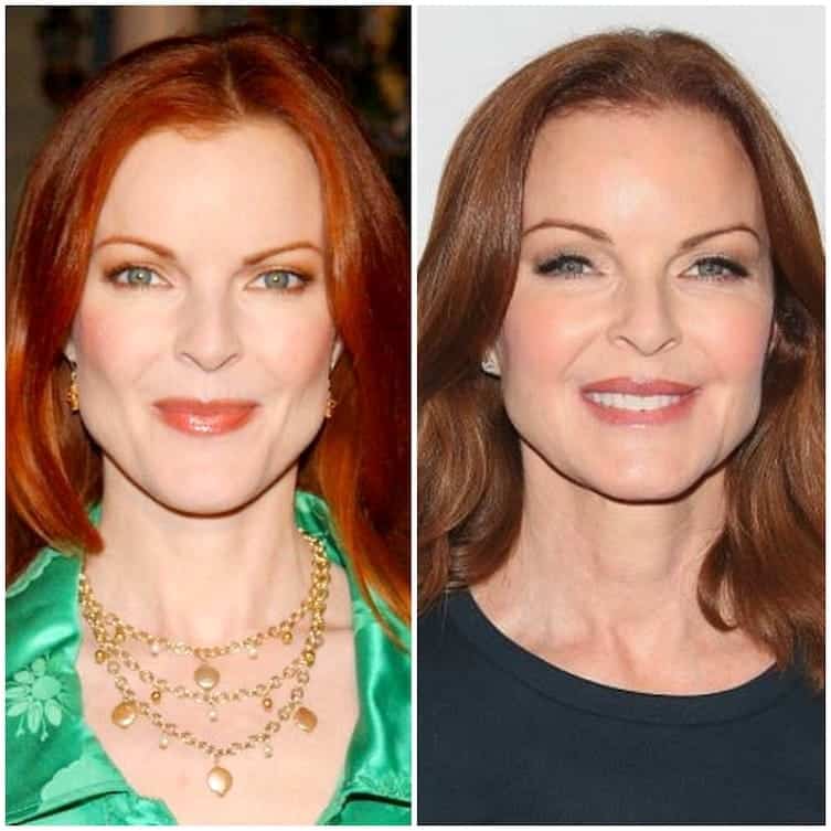 10 Desperate Housewives Actors Then And Now