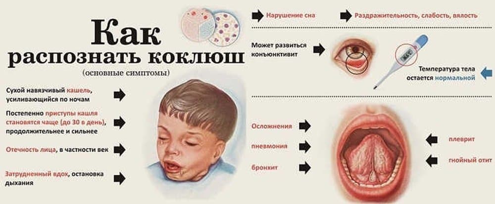 10 diseases of children that all parents should be able to distinguish