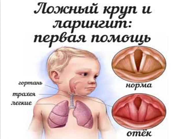 10 diseases of children that all parents should be able to distinguish