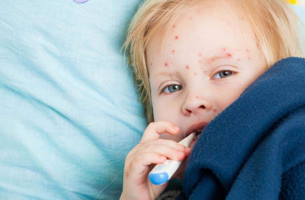 10 diseases of children that all parents should be able to distinguish