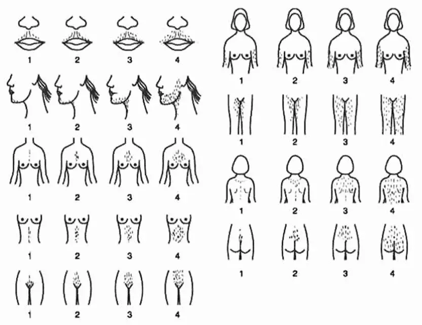 10 features of appearance that may indicate a latent course of the disease