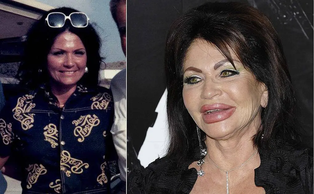 10 former beauties who mutilated themselves with plastic surgery