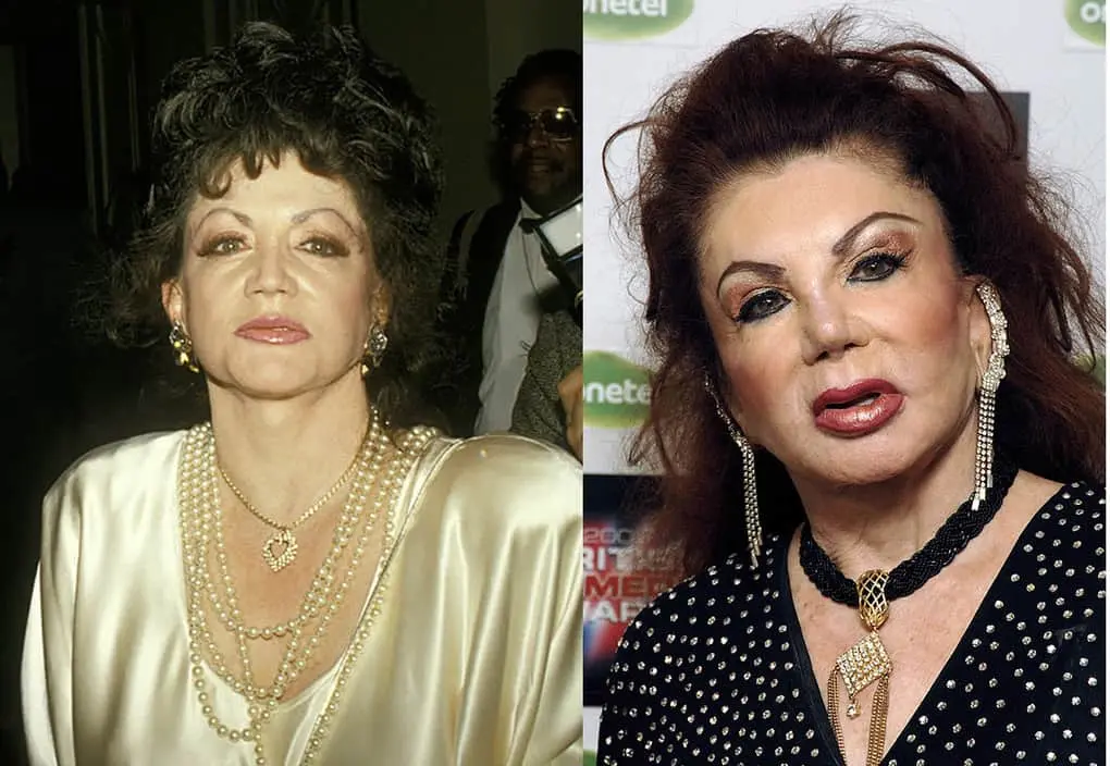 10 former beauties who mutilated themselves with plastic surgery