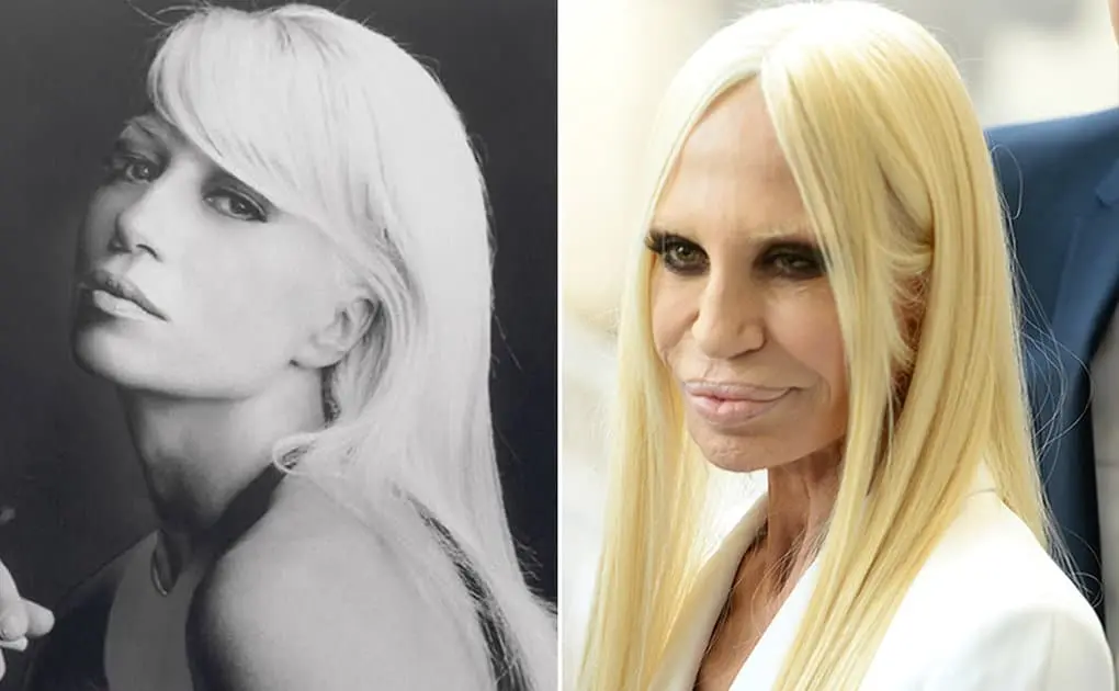 10 former beauties who mutilated themselves with plastic surgery