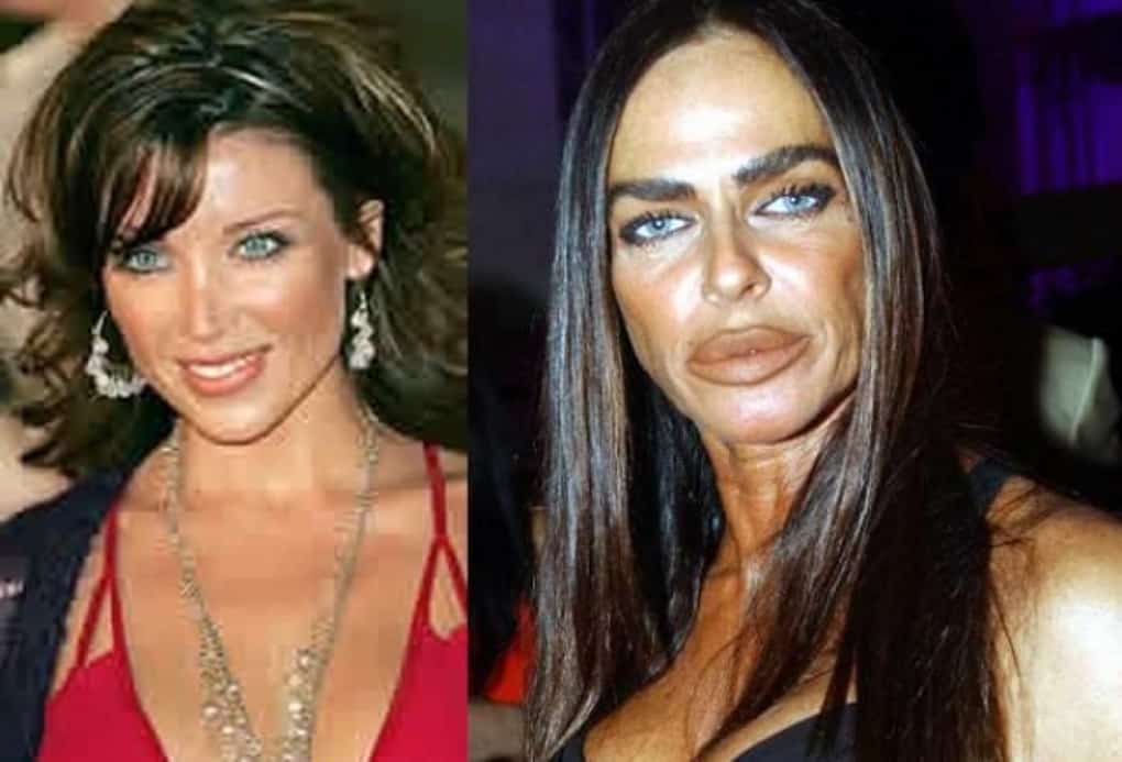 10 former beauties who mutilated themselves with plastic surgery