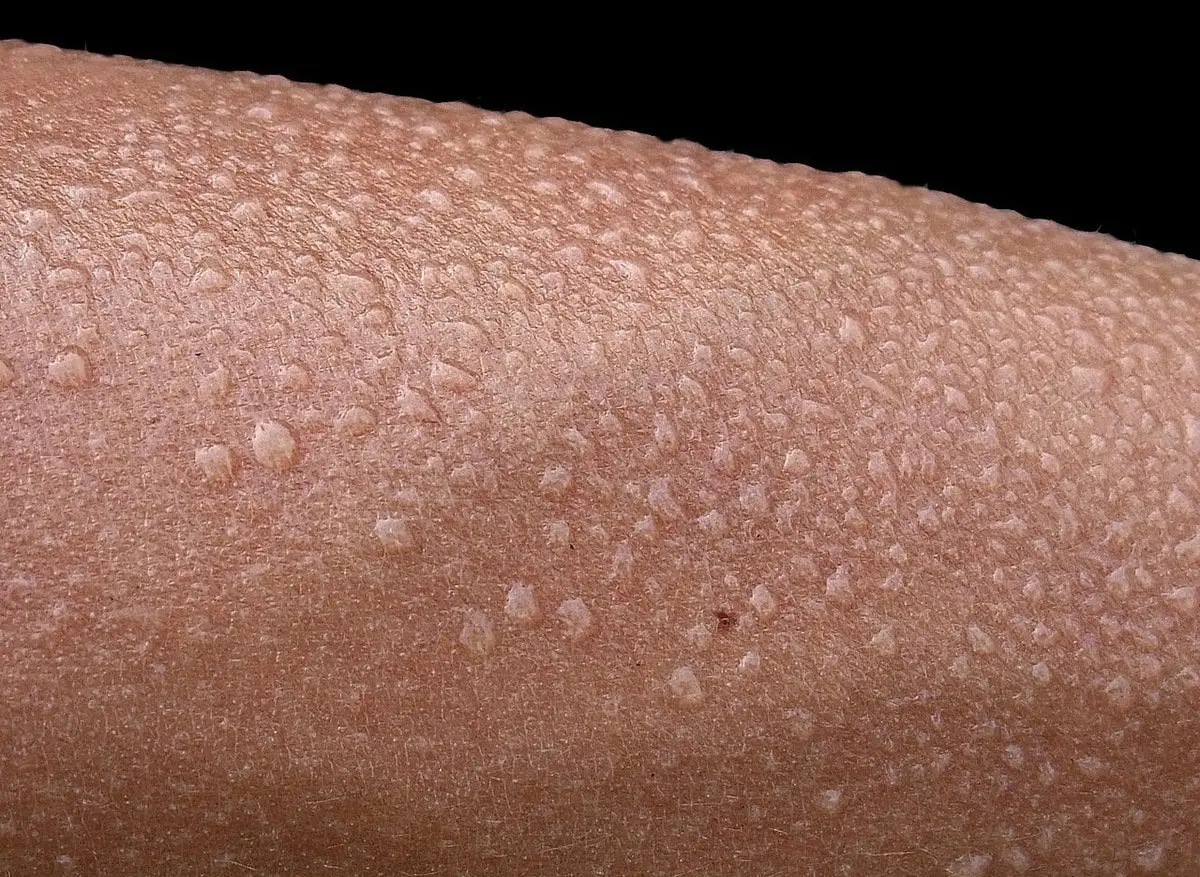 10 interesting facts about the skin of living organisms