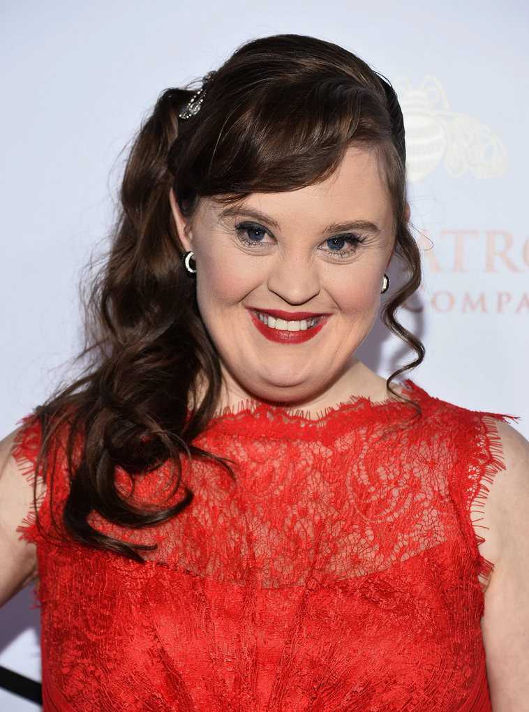 10 Most Successful People With Down Syndrome