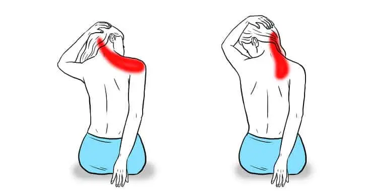 10 simple exercises to relieve tension in the neck and shoulders