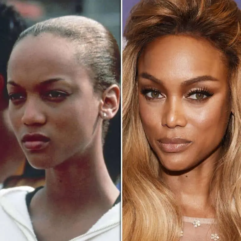 10 Stars Who Have Had Rhinoplasty Success